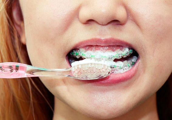 Higiene durante la ortodoncia